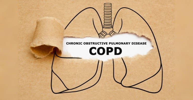 Explore J44.9_ Key ICD-10 Code for COPD